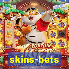 skins-bets