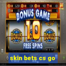 skin bets cs go