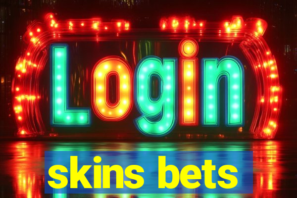 skins bets