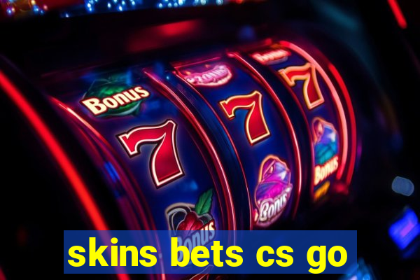 skins bets cs go