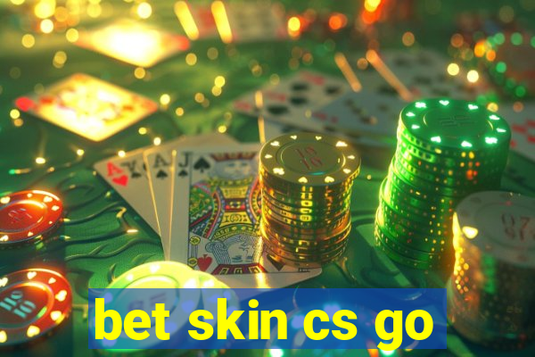 bet skin cs go