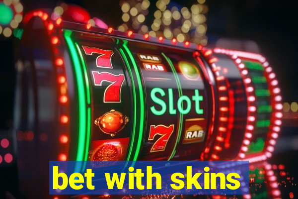 bet with skins